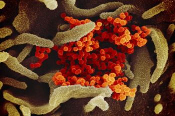 COVID-19 : Quelles sont les conditions d'éligibilité à l'aide de l'AESN pour l'hygiénisation des boues des STEP ?